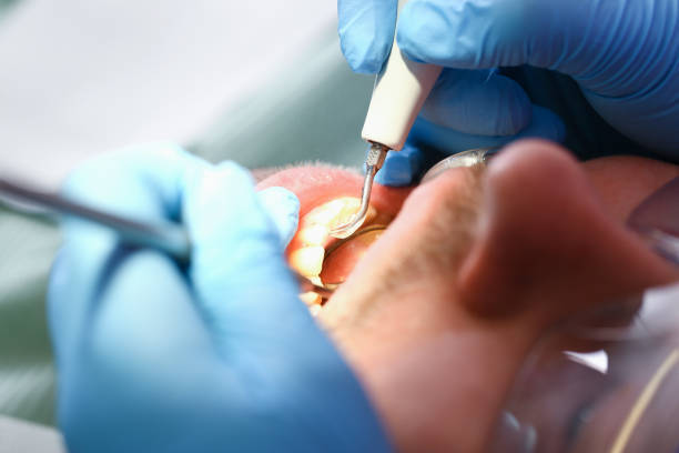 Best Broken or Cracked Tooth Emergency Dentist in Ashley, PA